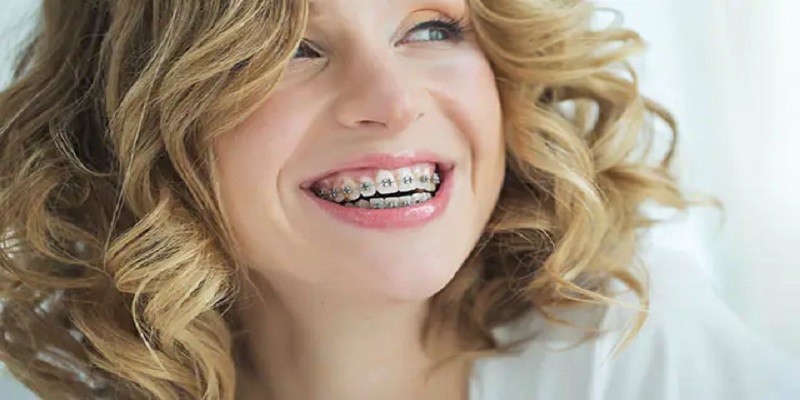 How Does Orthodontic Insurance Work
