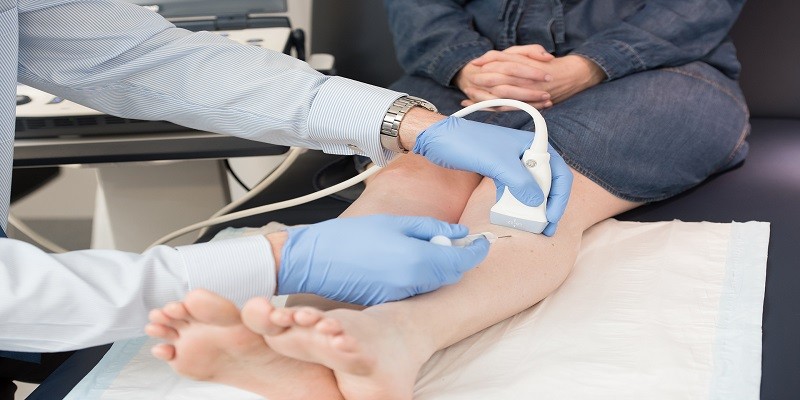 How Much Does Varicose Vein Treatment Cost Without Insurance