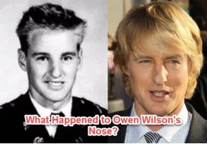 What Happened To Owen Wilson's Nose? The Untold Story Revealed - Rising