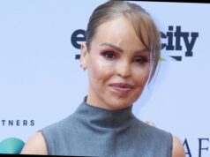 what happened to katie piper's face